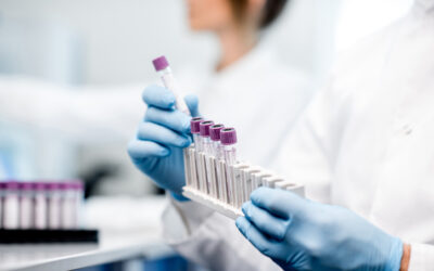 Black Patients Still Underrepresented In Clinical Trials Despite FDA Action Plan