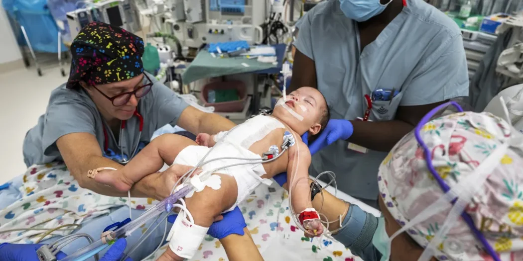 Conjoined Twins Successfully Separated and Ready to go Home