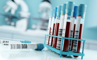 A Breakthrough in Alzheimer’s Diagnosis: The First FDA-Cleared Blood Test